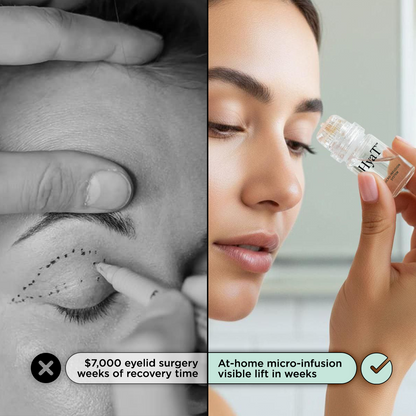 HyaT™ Upper Eyelid Matrixyl® 3000 & Adenosine Micro-Infusion System