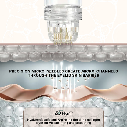 HyaT™ Upper Eyelid Matrixyl® 3000 & Adenosine Micro-Infusion System