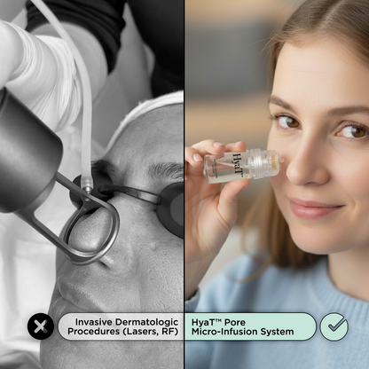 HyaT™ Pore Micro-Infusion System