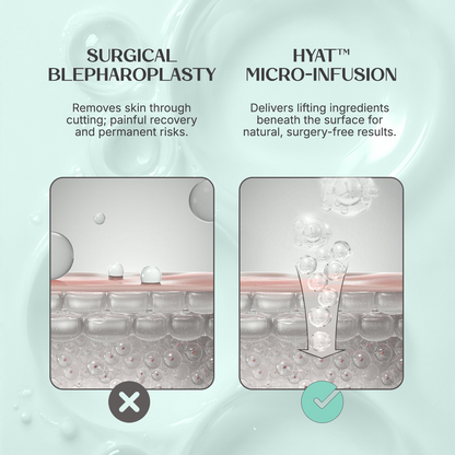 HyaT™ Upper Eyelid Matrixyl® 3000 & Adenosine Micro-Infusion System